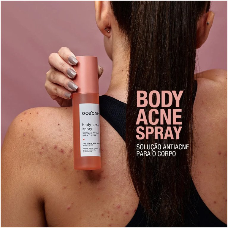 Body Acne Spray Solução Antiacne para o Corpo Océane 100ml - Image 3